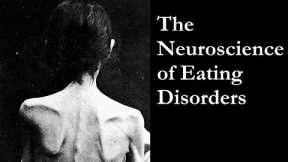 The Neuroscience of Eating Disorders