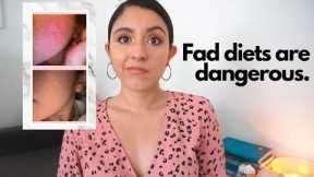 How Fad Diets Destroyed My Health | How to spot a fad diet!