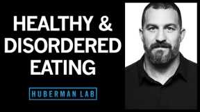 Healthy Eating & Eating Disorders - Anorexia, Bulimia, Binging | Huberman Lab Podcast #36