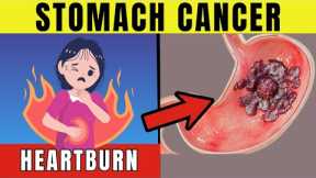 8 Warning SIGNS of STOMACH CANCER | Healthy Vibrance
